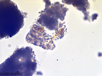 phyto/Scattered_Islands/europa/COMMA April 2011/Planktothrix sp (4.tif)(copy)_thumb.jpg